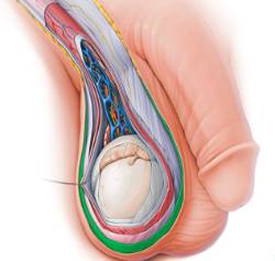 2025 07 09 Importancia de la autoexploración testicular (1)